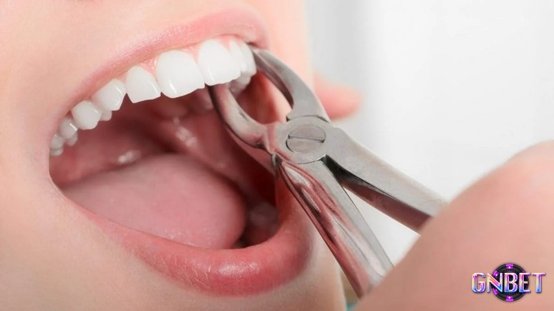 Giấc mơ thấy răng rụng có mối liên hệ mật thiết đến vấn đề sức khỏe của bạn