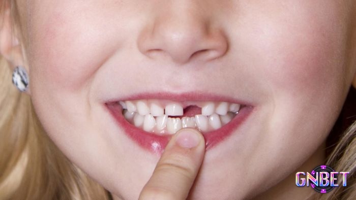 Giấc mơ thấy rụng răng cửa hàm trên có mối liên hệ đến những người lớn tuổi trong gia đình bạn