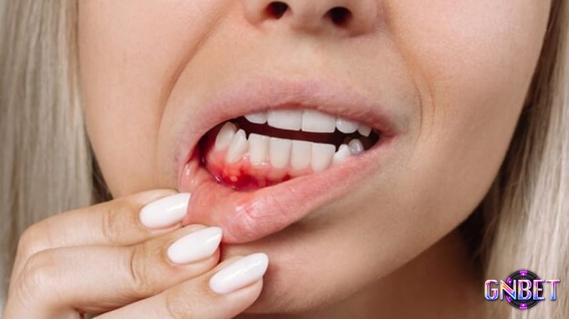 Giấc mơ thấy răng rụng số mấy mang đến cho bạn nhiều con số may mắn mỗi ngày